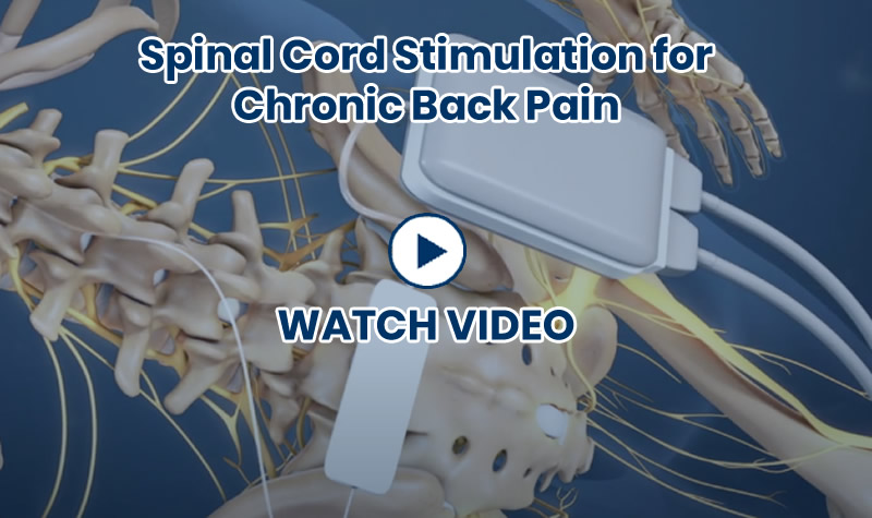 implanted spinal stimulator