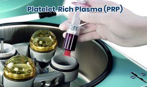 Treatments - Platelet Rich Plasma (PRP)